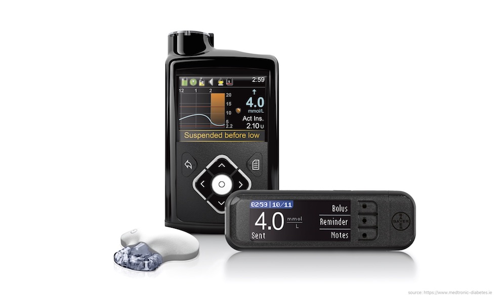 Medtronic 640g